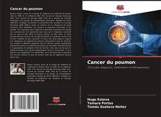 Cancer du poumon kitap kapağı