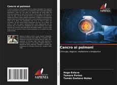 Bookcover of Cancro ai polmoni