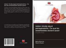 Bookcover of Lésion rénale aiguë périopératoire : Ce que les anesthésistes doivent savoir