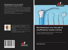 Bookcover of Manifestazioni oro-facciali di insufficienza renale cronica