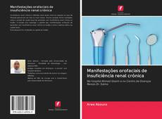 Bookcover of Manifestações orofaciais de insuficiência renal crônica