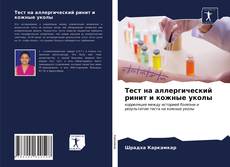 Bookcover of Тест на аллергический ринит и кожные уколы