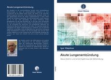 Bookcover of Akute Lungenentzündung
