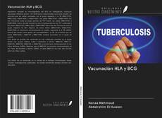 Buchcover von Vacunación HLA y BCG