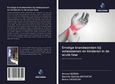 Couverture de Ernstige brandwonden bij volwassenen en kinderen in de acute fase