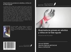 Bookcover of Quemaduras graves en adultos y niños en la fase aguda