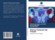 Capa do livro de Uterus-Tumoren bei Frauen 