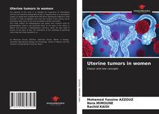 Uterine tumors in women的封面