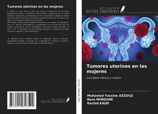 Capa do livro de Tumores uterinos en las mujeres 