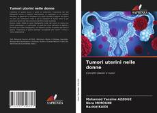 Tumori uterini nelle donne的封面