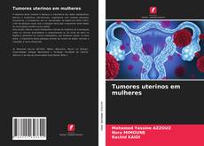 Bookcover of Tumores uterinos em mulheres
