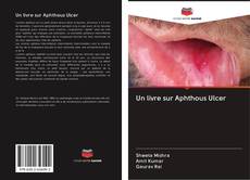 Un livre sur Aphthous Ulcer kitap kapağı