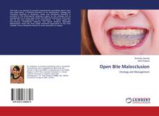 Buchcover von Open Bite Malocclusion