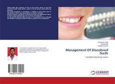 Buchcover von Management Of Discolored Teeth