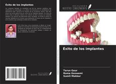 Capa do livro de Éxito de los implantes 