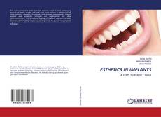 Copertina di ESTHETICS IN IMPLANTS