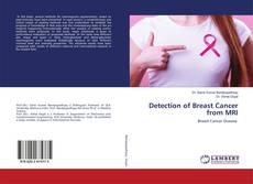 Buchcover von Detection of Breast Cancer from MRI