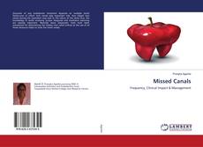 Buchcover von Missed Canals