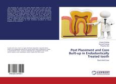 Buchcover von Post Placement and Core Built-up in Endodontically Treated tooth