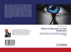 Buchcover von Effect of Xylocaine on Tear Production