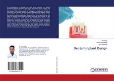 Buchcover von Dental Implant Design