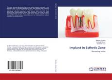Buchcover von Implant In Esthetic Zone