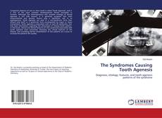 Buchcover von The Syndromes Causing Tooth Agenesis