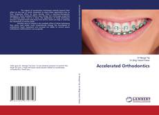 Buchcover von Accelerated Orthodontics