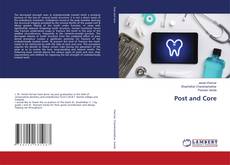 Copertina di Post and Core