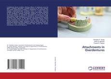 Copertina di Attachments In Overdentures