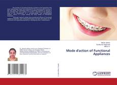 Copertina di Mode d'action of Functional Appliances