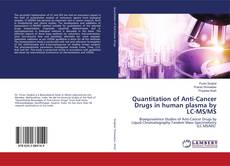 Copertina di Quantitation of Anti-Cancer Drugs in human plasma by LC-MS/MS