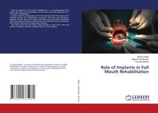 Couverture de Role of Implants in Full Mouth Rehabilitation