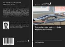 Bookcover of Tratamiento terapéutico de la espondilosis lumbar