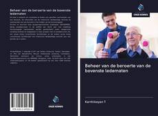 Bookcover of Beheer van de beroerte van de bovenste ledematen