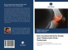 Couverture de Eine morphometrische Studie über Patella beim Knie-Totalersatz