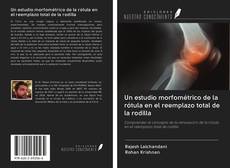 Обложка Un estudio morfométrico de la rótula en el reemplazo total de la rodilla