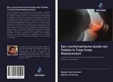 Bookcover of Een morfometrische studie van Patella in Total Knee Replacement