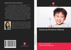 Bookcover of Cáries da Primeira Infância
