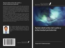 Bookcover of Apnea obstructiva del sueño y enfermedad periodontal