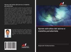 Buchcover von Apnea ostruttiva del sonno e malattia parodontale