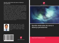 Bookcover of Apnéia obstrutiva do sono e doença periodontal