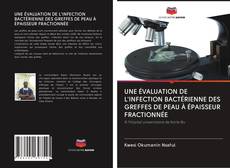 Bookcover of UNE ÉVALUATION DE L'INFECTION BACTÉRIENNE DES GREFFES DE PEAU À ÉPAISSEUR FRACTIONNÉE