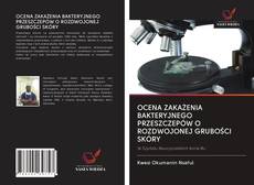 Portada del libro de OCENA ZAKAŻENIA BAKTERYJNEGO PRZESZCZEPÓW O ROZDWOJONEJ GRUBOŚCI SKÓRY