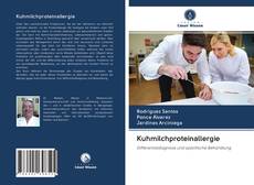 Bookcover of Kuhmilchproteinallergie