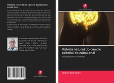 Bookcover of História natural do cancro epitelial do canal anal