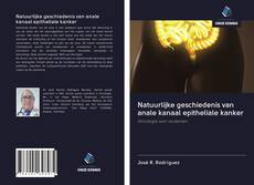 Couverture de Natuurlijke geschiedenis van anale kanaal epitheliale kanker