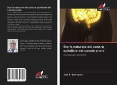 Couverture de Storia naturale del cancro epiteliale del canale anale