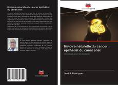 Histoire naturelle du cancer épithélial du canal anal kitap kapağı