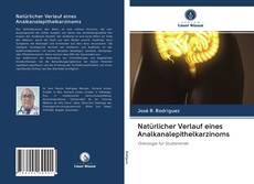 Capa do livro de Natürlicher Verlauf eines Analkanalepithelkarzinoms 